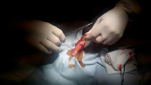 Nemocnice Havlkv Brod oteve novou specializovanou chirurgickou ambulanci